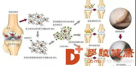關(guān)節(jié)軟骨再生最新進(jìn)展與觀點(diǎn)論述揭秘
